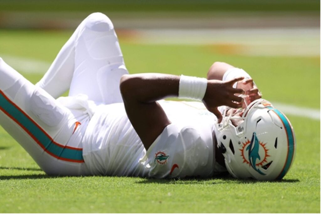 NFL’s Next Step in Concussion Care: Beyond Equipment and Rules